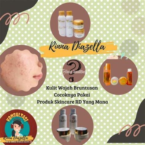 Paket Skin Care Rinna Diazella Menghilangkan Jerawat Dan Flek Hitam Di