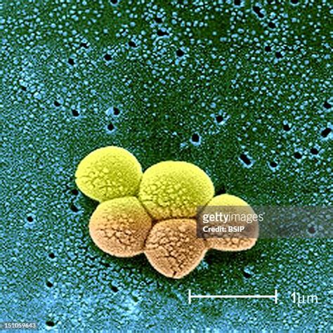 Methicillin Resistant Staphylococcus Aureus Photos And Premium High Res