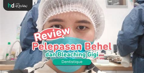 Review Pemasangan Behel Metal Hdmall