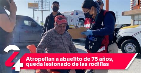 Atropellan a abuelito de 75 años queda lesionado de las rodillas