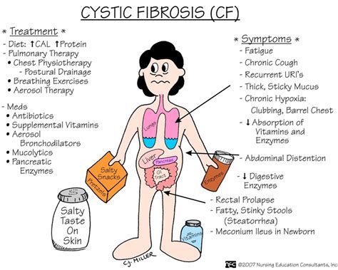 Nursing Considerations For Cystic Fibrosis Ask The Nurse Expert