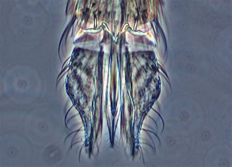 Mosquito Proboscis | Nikon’s MicroscopyU