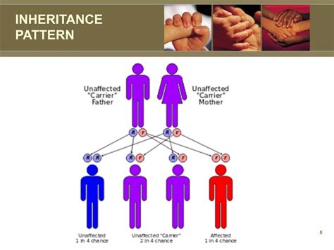 Xeroderma Pigmentosum Ppt