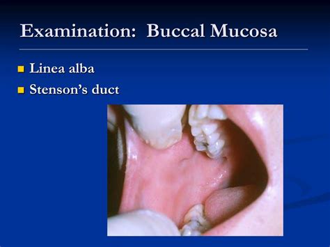 Ppt Examination Of The Oral Cavity Powerpoint Presentation Free