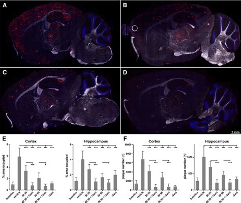 Efficacy Of Mono And Combination Treatments On Brain Amyloid Burden