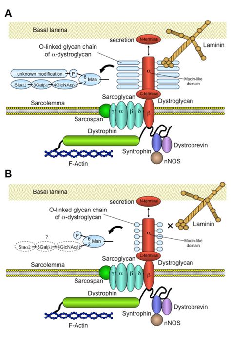 The dysfunction of α dystroglycan in Fukuyama type congenital MD