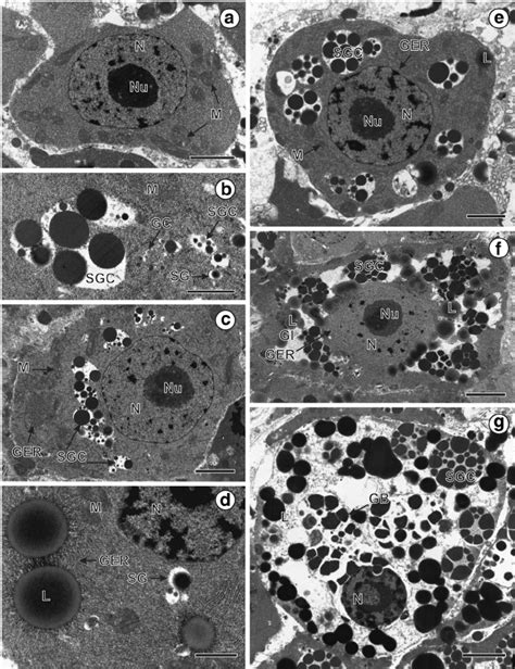 Consecutive stages of vitellogenesis in Ligula intestinalis and details ...