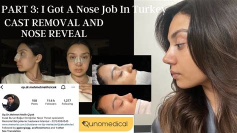 I GOT A NOSE JOB IN TURKEY ISTANBUL PART 3 QUNOMEDICAL CAST REMOVAL