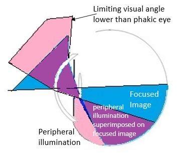 A Provides An Additional Perspective On The Peripheral Light Paths By