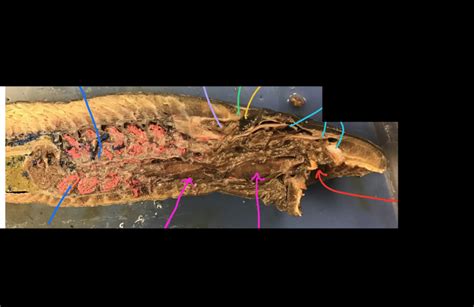 Lamprey Dissection Id Respiratory Saggital Crossection Diagram Quizlet