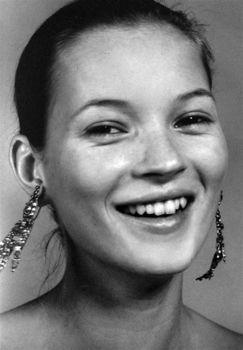 Kate Moss Teeth