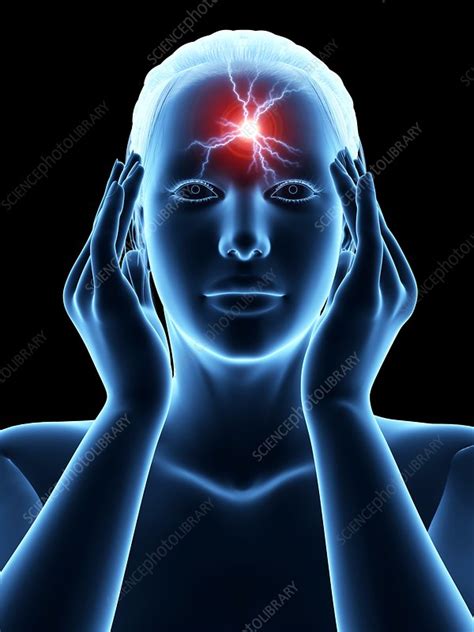 Human Headache Illustration Stock Image F Science Photo