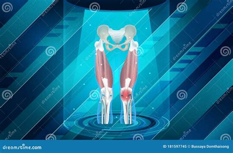 New Technology For Knee Bone Injury Abstract Traumatology And