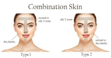 Combination Skin ⋆