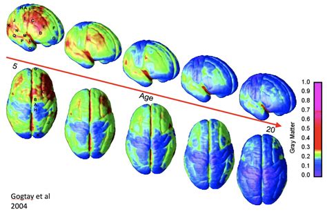 Brain Basics Adolescent Brain Changes To Age Reward Foundation