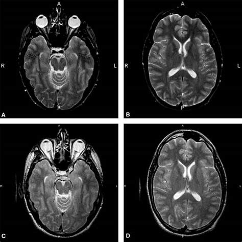 Fast Versatile And Cost Effective FSE MR Imaging Technical