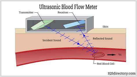 Ultrasonic Flow Meters Ultrasonic Flow Meter Applications