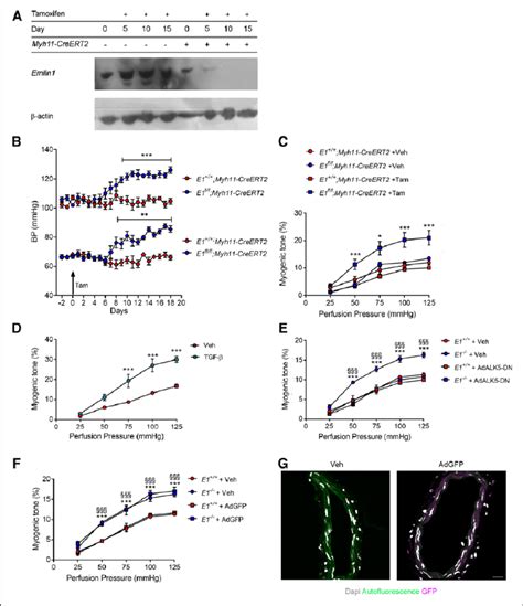 Emilin 1 Elastin Microfibrils Interface Located Protein 1 Deletion In