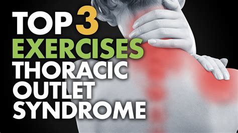 Top 3 Exercises For Thoracic Outlet Syndrome Youtube