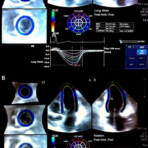 Pdf Relation Between Parameters Of Myocardial Mechanics And