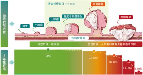 做肠镜太麻烦，你可以选择肠癌早筛新方式 粪便基因检测 哔哩哔哩