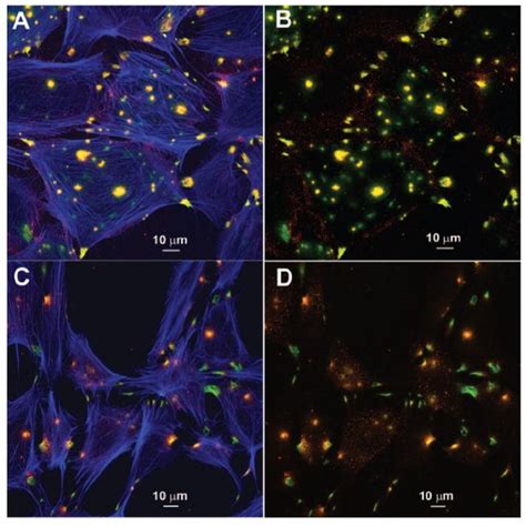 Stages Of Invadopodia Formation And Function A Identification Of Four