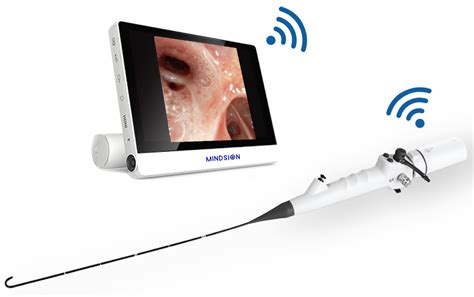 Mindsion Ent Video Portable Ent Endoscope Ibsmedic