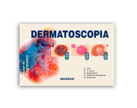 DERMATOSCOPIA Pautas de diagnóstico