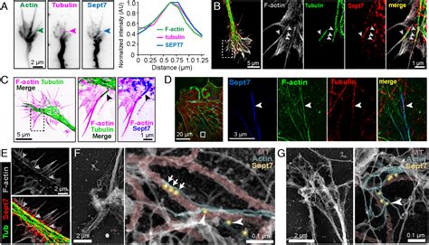 Septins Mediate A Microtubuleactin Crosstalk That Enables Actin Growth