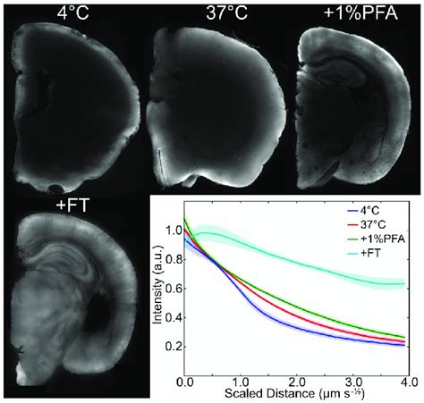 Dextran Fitc Diffusion In Brain Specimens Mm Slices From A Mm