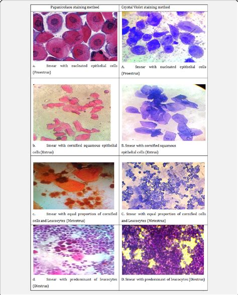 Table From A Comparative Study On Staining Techniques For Vaginal