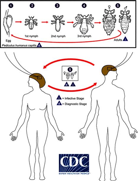 Pediculosis Capitis Pubis Corporis Symptoms Diagnosis Treatment