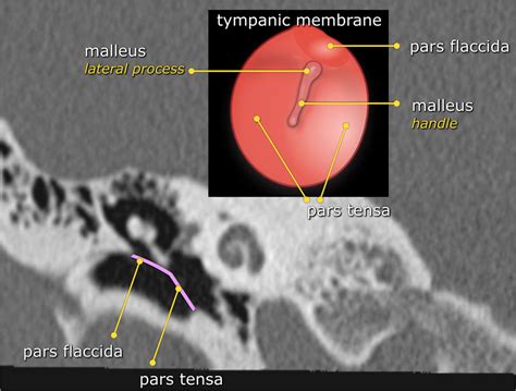 Temporal Bone Anatomy Ct Anatomical Charts Posters