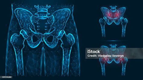 Bones Of The Pelvis And Hip Human Anatomy Pelvic And Hip Injuries X Ray Of The Hip Joint Made Of