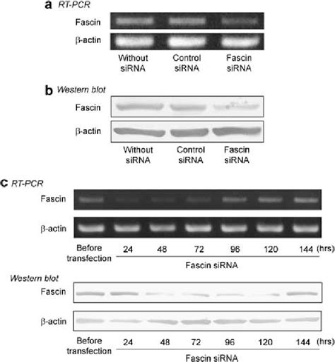 Expression Of Fascin In CCKS 1 After Transfection Of SiRNA Against