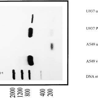 Rt Pcr Gel Showing A Bp Dna Band Representing The Pro Il Band For