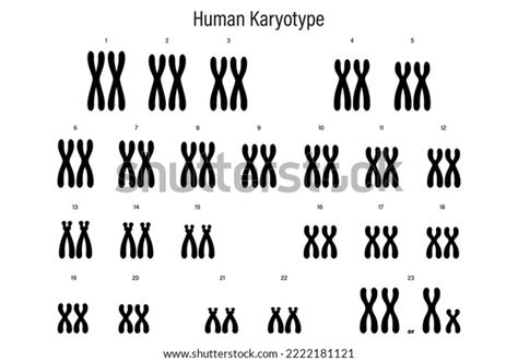 Human Karyotype Autosome Sex Chromosome Male Stock Vector Royalty Free