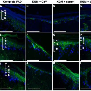 Expression of keratinocyte differentiation markers. (A-L) Eight micron ...