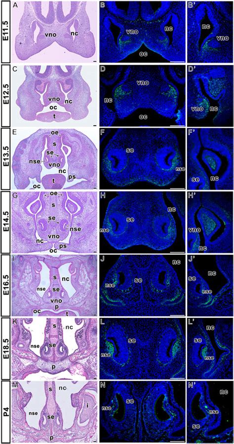 Activation Of Sonic Hedgehog Signaling By A Smoothened 44 Off