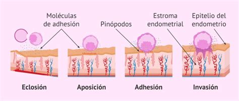 C Mo Es La Implantaci N De Embriones En El Tero S Ntomas Comunes