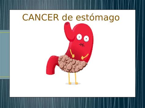 Cáncer Gástrico Macarena Yohan Gonzalez uDocz