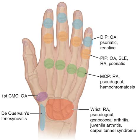 Upper Limb Joints Presentation