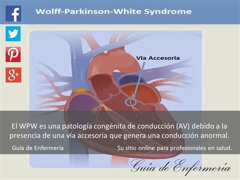 Wolff Parkinson White Syndrome GuÍa De EnfermerÍa