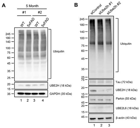 Ijms Free Full Text Predictive Potential Of Circulating Ube2h Mrna