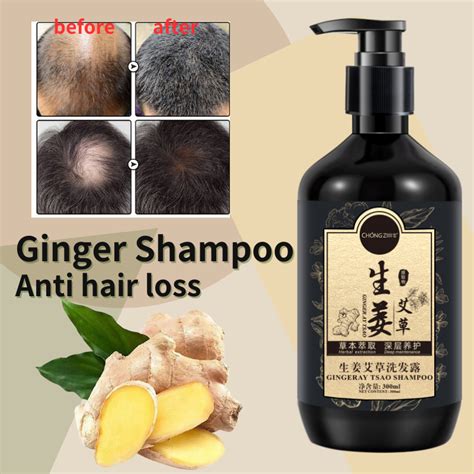 Ginger Mugwort Shampoo 300ml Anti Dandruff Anti Itch Oil Control Anti Hair Loss Shopee Philippines