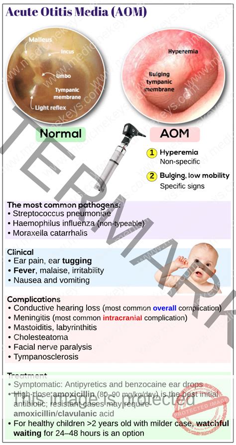 Acute Otitis Media Aom Medicine Keys For Mrcps