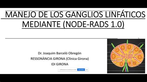 474 Manejo de los ganglios linfáticos mediante Node RADS YouTube