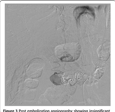 Structure of gastroduodenal artery | Semantic Scholar