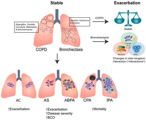 Jof Free Full Text Clinical Aspergillus Signatures In Copd And