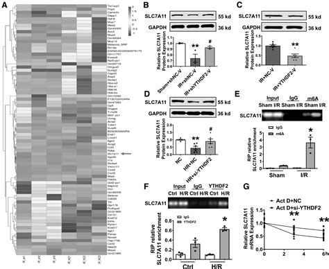 YTHDF2 Promotes Cardiac Ferroptosis Via Degradation Of SLC7A11 In